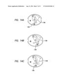 SHIELD LOCKOUT FOR BLADED OBTURATOR AND TROCARS diagram and image