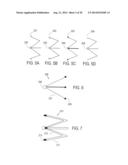 METHODS AND DEVICES FOR DEPLOYMENT INTO A LUMEN diagram and image