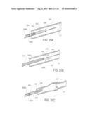 METHODS AND DEVICES FOR DEPLOYMENT INTO A LUMEN diagram and image