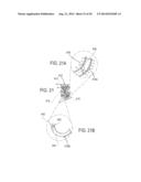 METHODS AND DEVICES FOR DEPLOYMENT INTO A LUMEN diagram and image