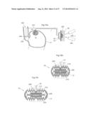 DEVICE FOR TREATING OBESITY diagram and image