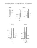 DEVICE FOR TREATING OBESITY diagram and image