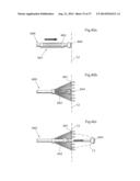 DEVICE FOR TREATING OBESITY diagram and image