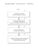 DEVICE FOR TREATING OBESITY diagram and image