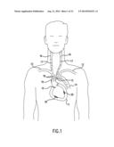 Anti-Embolic Device and Method diagram and image