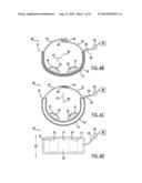 Anti-Embolic Device and Method diagram and image