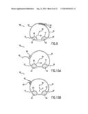 Anti-Embolic Device and Method diagram and image