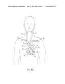 Anti-Embolic Device and Method diagram and image