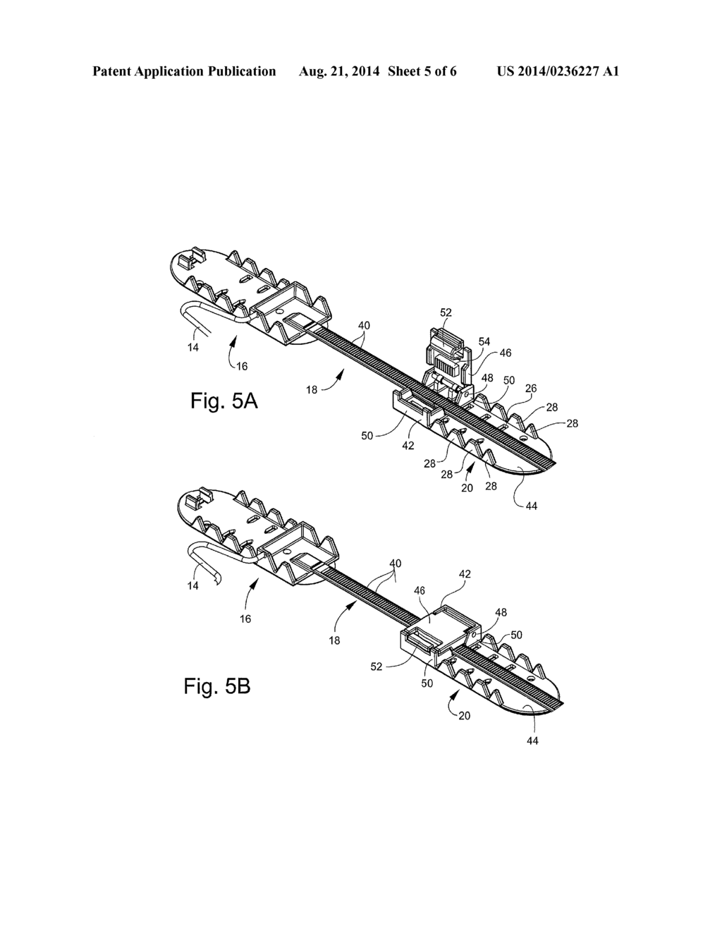 SYSTEM FOR CLOSING A WOUND - diagram, schematic, and image 06