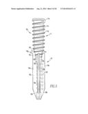 TISSUE GRAFT ANCHOR ASSEMBLY AND INSTRUMENTATION FOR USE THEREWITH diagram and image