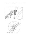 TISSUE GRAFT ANCHOR ASSEMBLY AND INSTRUMENTATION FOR USE THEREWITH diagram and image