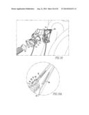 TISSUE GRAFT ANCHOR ASSEMBLY AND INSTRUMENTATION FOR USE THEREWITH diagram and image