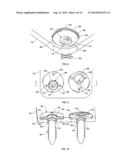 SPINAL PLATE WITH COMPRESSION LOCKING diagram and image