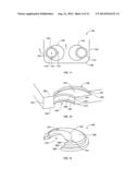 SPINAL PLATE WITH COMPRESSION LOCKING diagram and image