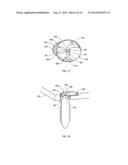 SPINAL PLATE WITH COMPRESSION LOCKING diagram and image