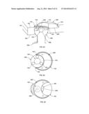 SPINAL PLATE WITH COMPRESSION LOCKING diagram and image