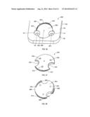 SPINAL PLATE WITH COMPRESSION LOCKING diagram and image