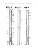 METHOD FOR IMPLANTING A ROD IMPLANT ALONG A SPINE OF A PATIENT diagram and image