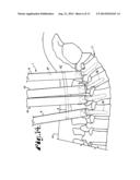 METHOD FOR IMPLANTING A ROD IMPLANT ALONG A SPINE OF A PATIENT diagram and image