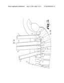 METHOD FOR IMPLANTING A ROD IMPLANT ALONG A SPINE OF A PATIENT diagram and image