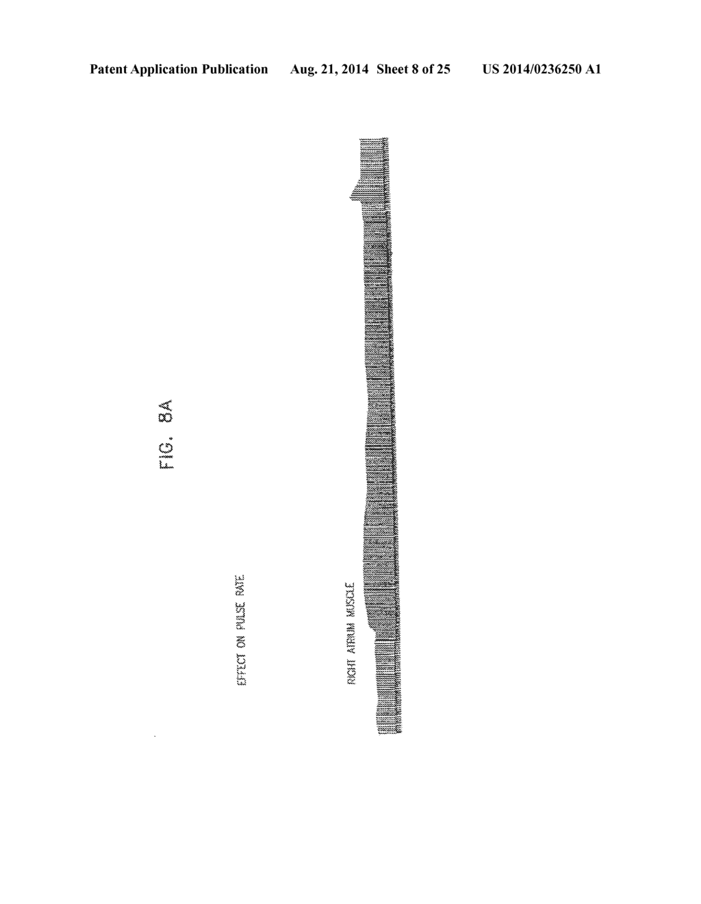 ELECTRICAL MUSCLE CONTROLLER - diagram, schematic, and image 09