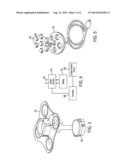 CUTANEOUS FIELD STIMULATION WITH DISPOSABLE AND RECHARGEABLE COMPONENTS diagram and image