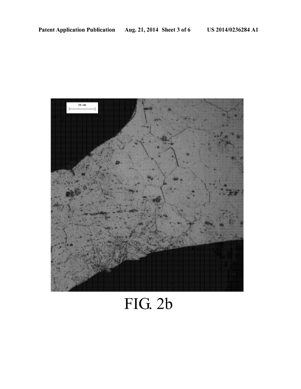 Bioerodible Magnesium Alloy Microstructures for Endoprostheses - diagram, schematic, and image 04