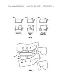 Expandable Fusion Device and Method Installation Thereof diagram and image