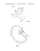 Systems and Apparatuses for Inserting an Implant in Intervertebral Space diagram and image