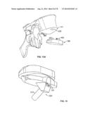 Systems and Apparatuses for Inserting an Implant in Intervertebral Space diagram and image