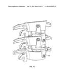 Systems and Apparatuses for Inserting an Implant in Intervertebral Space diagram and image