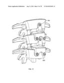 Systems and Apparatuses for Inserting an Implant in Intervertebral Space diagram and image