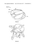 Systems and Apparatuses for Inserting an Implant in Intervertebral Space diagram and image