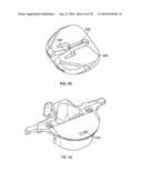 Systems and Apparatuses for Inserting an Implant in Intervertebral Space diagram and image