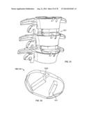 Systems and Apparatuses for Inserting an Implant in Intervertebral Space diagram and image