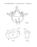 Systems and Apparatuses for Inserting an Implant in Intervertebral Space diagram and image