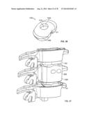 Systems and Apparatuses for Inserting an Implant in Intervertebral Space diagram and image