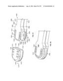 Systems and Apparatuses for Inserting an Implant in Intervertebral Space diagram and image