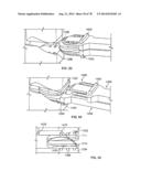 Systems and Apparatuses for Inserting an Implant in Intervertebral Space diagram and image