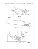 Systems and Apparatuses for Inserting an Implant in Intervertebral Space diagram and image