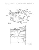 Systems and Apparatuses for Inserting an Implant in Intervertebral Space diagram and image