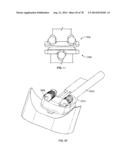 Systems and Apparatuses for Inserting an Implant in Intervertebral Space diagram and image