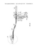 Systems and Apparatuses for Inserting an Implant in Intervertebral Space diagram and image