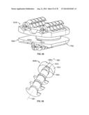 Systems and Apparatuses for Inserting an Implant in Intervertebral Space diagram and image