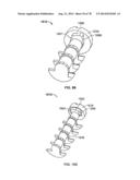 Systems and Apparatuses for Inserting an Implant in Intervertebral Space diagram and image