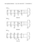 Systems and Apparatuses for Inserting an Implant in Intervertebral Space diagram and image