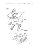 Systems and Apparatuses for Inserting an Implant in Intervertebral Space diagram and image