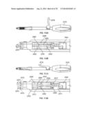 Systems and Apparatuses for Inserting an Implant in Intervertebral Space diagram and image