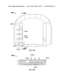 Systems and Apparatuses for Inserting an Implant in Intervertebral Space diagram and image