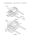 Systems and Apparatuses for Inserting an Implant in Intervertebral Space diagram and image